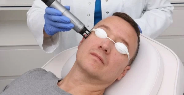 nano-q-lasersko-lecenje-rosacea-diva-poliklinika