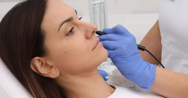 Skidanje bradavica Poliklinika Diva